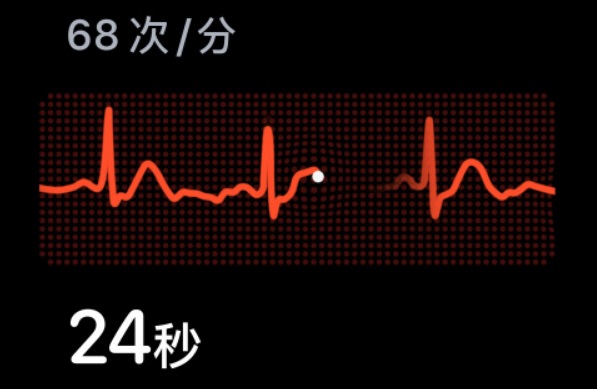 苹果发布新技术，用心跳解锁 iPhone