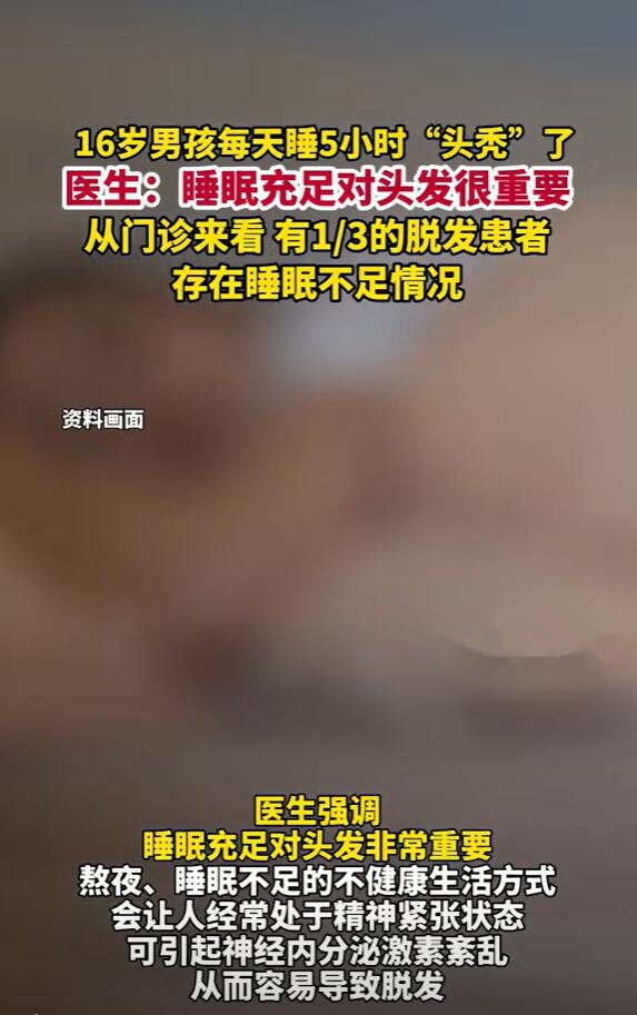 16岁男孩每天只睡5小时头秃了 医生：睡眠不足 精神压力大导致