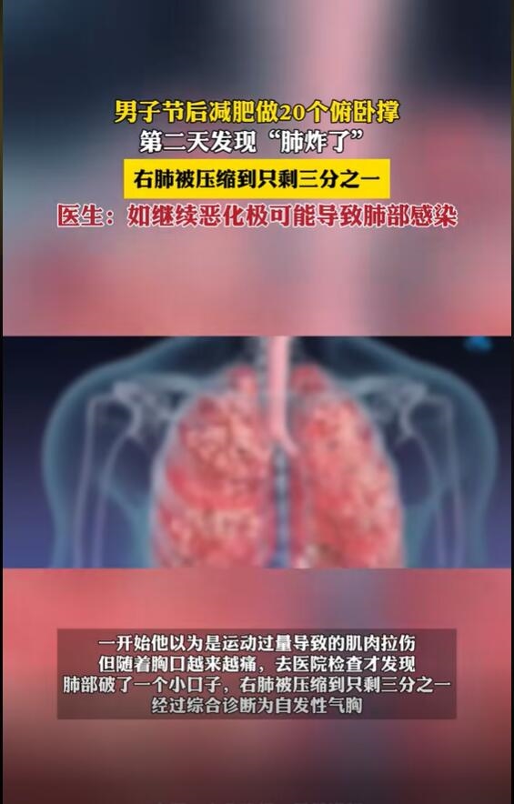 男子减肥做20个俯卧撑后“肺炸了”：右肺被压缩到只剩三分之一